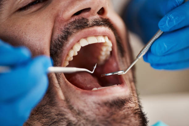Emergency Dental Services in San Jacinto, CA
